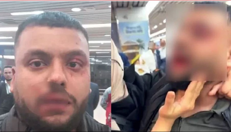 শাহজালাল বিমানবন্দরে নিরাপত্তাকর্মীদের মারপিটে রক্তাক্ত প্রবাসী, গুনলেন জরিমানাও